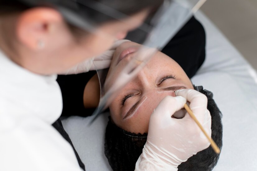 Preparation for the Eyebrow Architecture Procedure