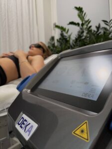 Лазерная депиляция Goetheplatz